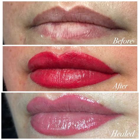 lip tattoos before and after.